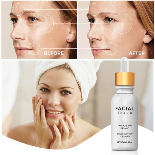 Отбеливающие сыворотки для лица Ashowner China At AliExpress