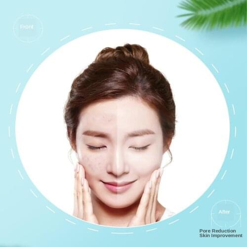 Blackhead Remover Pore Vacuum 3 Modes Deep Cleansing Electric Extractor