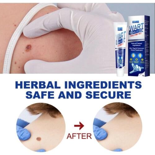 EELHOE Wart Skin Tag Remover Cream Antibacterial Herbal Extract Foot Corn Plaster Warts Treatments Ointment Skin Care Creams