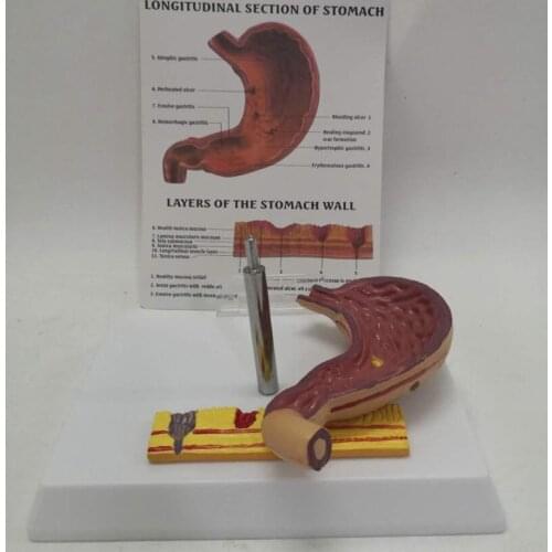 Human Longitudinal Section Stomach Layers Anatomical Pathological Model Teaching Resources