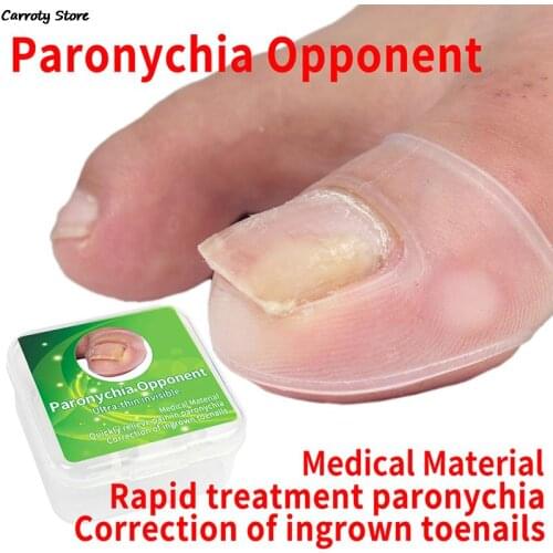 1Pair Silicone Invisible Ingrown Toenail Correction Tool Toe Nail Treatment Elastic Straightening Clip Brace Pedicure Tool New