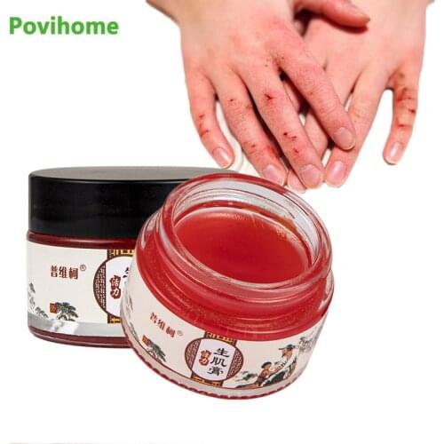 1Pcs 30g Herbal Bedsore Cream Rapid Wound Healing Removal Rot Festering Myogenic Prevent Infection Ointment Body Care Plaster