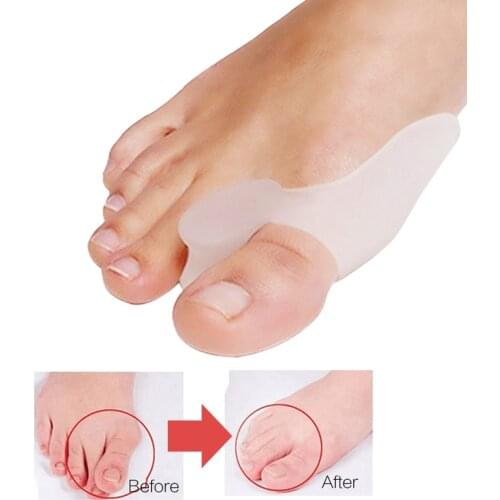 2Pcs Special Hallux Valgus Pro Protector Bone Thumb Orthotics Braces Corrector Soft Silicone Foot Big Toe Separator Pedicure