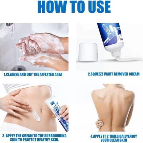 Anti-spot Gel Wart Removal Body Wart Treatment Cream Care Remover And Skin Cleansing Foot Safe Effective Cream Wart Cream Z3H4