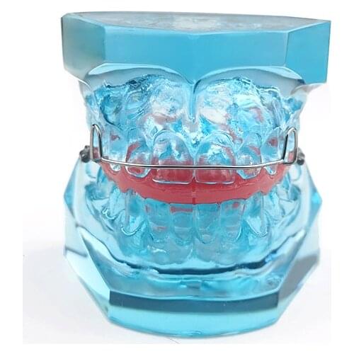Orthodontic Model with Retainer Removable Model Dental Teach Study Teeth Model
