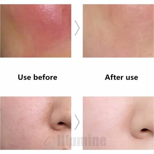 Highend Ceramide Solution Essence Replenishment Repair Anti Allergy Brighten Skin Tone Repair Cuticle 1000ml OEM Beauty Salon