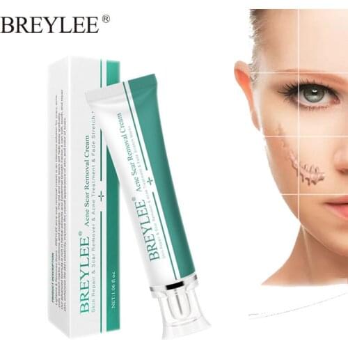 BREYLEE Acne Scar Removal Cream Scar Remover Acne Treatment Skin Repair Fade Stretch Marks Body Scar Moisturizing Skin Care