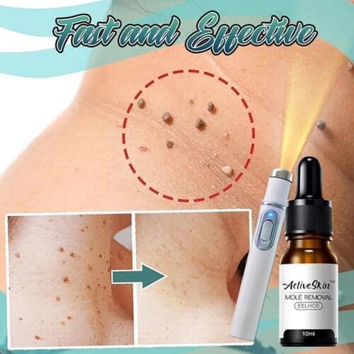 Skin Tag Remove Against Mole Wart Remove Spot Anti Tool Warts Foot Moles Corn Rapidly Skin Removal Care Papillomas Removes
