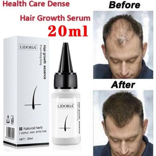 Hair Care Hair Growth Essential Oils Essence Original Authentic 100% Hair Loss Liquid Health Care Beauty Dense Hair Growth Serum