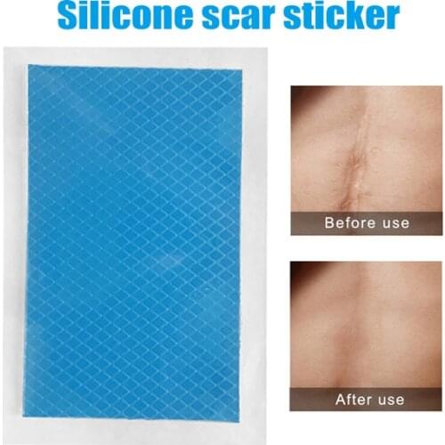 Silicone Scar Therapy Sticker Remove Trauma Burn Silicon Patch Reusable Acne Gel Skin Repair can CSV
