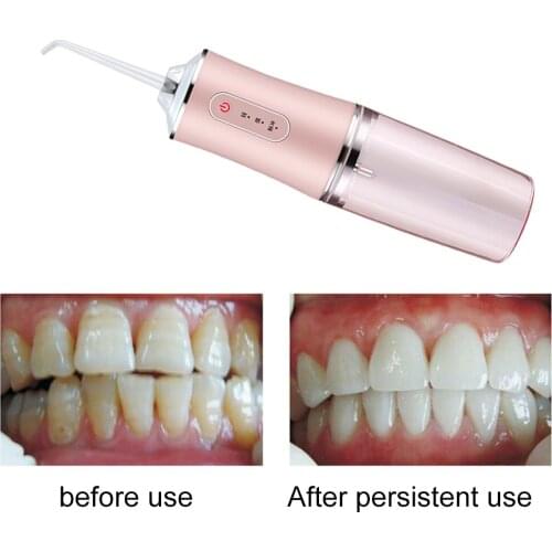 Oral Irrigator Dental Scaler Water Floss Pick Jet Flosser For Teeth Cleaning Tools Care Whitening Cleaner Tartar Removal Tool