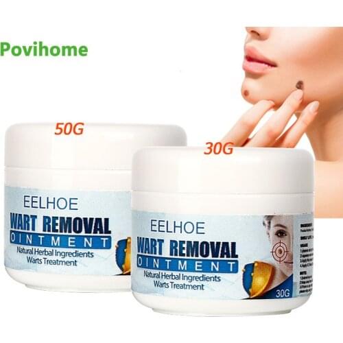 30/50g Herbal Warts Remover Cream Remove Skin Tag Mole Corns Ointment Antibacterial Traditional Chinese Medicine Care Plaster