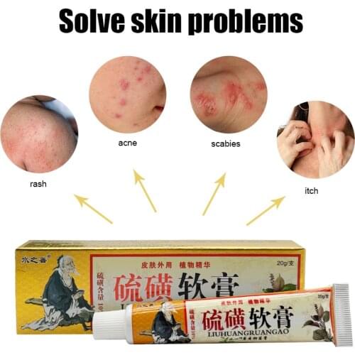 ZB sulfur itching Dermatitis Eczema Psoriasis Herbal Cream compound ketoconazole ointment slim