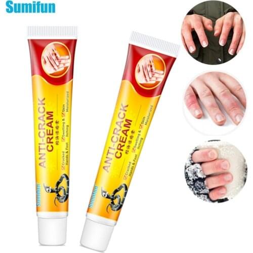 Sumifun 2Pcs Frostbite Ointment Herbal Repair Cream Anti-Drying Chapped Nourish Moisturize Skin Care Chinese Hand Foot Crack Oil