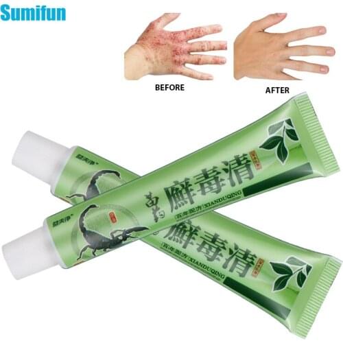 1pc Herbal Psoriasis Ointment Scorpion Cream Dermatitis Eczema Treatment Pruritus Antibacterial Itching Plaster Skin Care