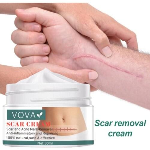Acne Scar Removal Cream Pimples Stretch Marks Face Cream Remove Acne Smoothing Whitening Moisturizing Body Skin Care 30ml