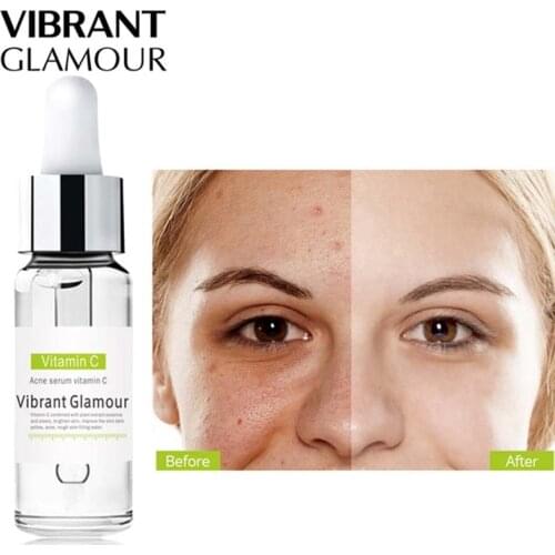 Tea Tree Acne Repair Face Serum Scar Acne Treatment Oil Control Essence Anti Acne Marks For Sensitive Skin Care Essence 15ml