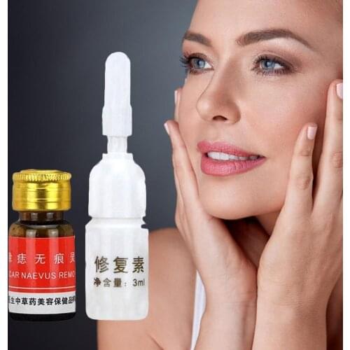 Mole Removal Cream Freckle Removal Cream Professional Face Solution Solution Painless Repair Removal Care Treatment Acne H9D9