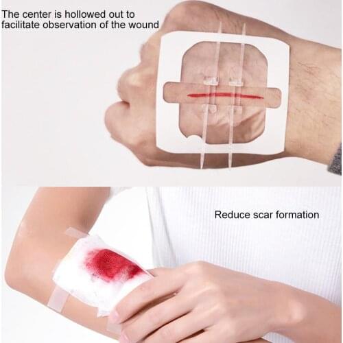 1pc Zipper Band-aid Painless Wound Closure Device Without Needles Suture-free Wound Dressing Patch Zip Suture Reducer Band Aid