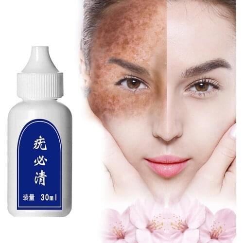 Useful Skin Tag Remover Wart Treatment Removal Mole Papillomas Corn Repair Tool Natural Bacteriostatic Verruca removing liquid