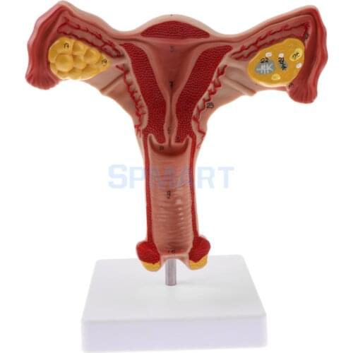 PVC Simulation 1:1 Human Female Uterus Ovary Fallopian Tubes Model Anatomical Study Display for School Teaching Tool Lab Supply