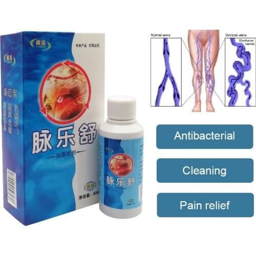Varicose Veins Spray Treatment Leg Acid Bilges Itching Lumps Bad Leg Cure Chinese Vasculitis Luqied Medicine Body Care