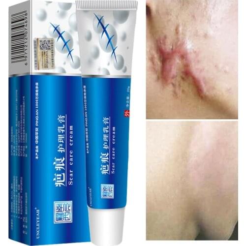 Acne Scar Removal Cream Pimples Stretch Marks Face Gel Remove Acne Smoothing Whitening Moisturizing Body Skin Care Aichun