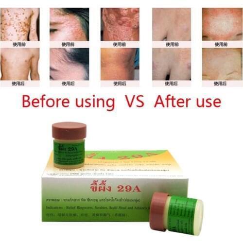 10pcs/Thailand 29A Natural Ointment Psoriasi Eczma Cream Works Really Well For Dermatitis Psoriasis Eczema Urticaria Beriberi