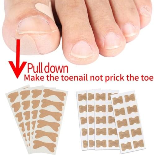 1pcs Professional Ingrown Toenail Foot Corrector Stickers Elasticity Toe Nail Care Pedicure Tools Health Care Protects Toe Nail
