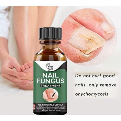 Nail Repair Liquid Hand And Foot Onychomycosis Care Antibacterial For Nail Cracking Roughness Discoloration Nail Care TSLM1