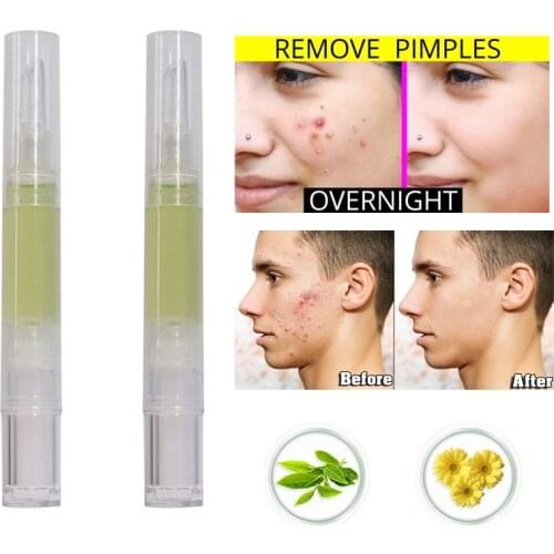 Tea Tree Essence Ance Remove Pen stick Blemish Pimple Remover Serum Intense Fast Heal Red Acne Spots