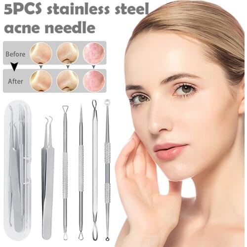 5 Piece Tool Set For Blackhead Remover Acne Extractor Removal Tool For Acne Pimples Skin Care Face Care Cuidado De La Cara