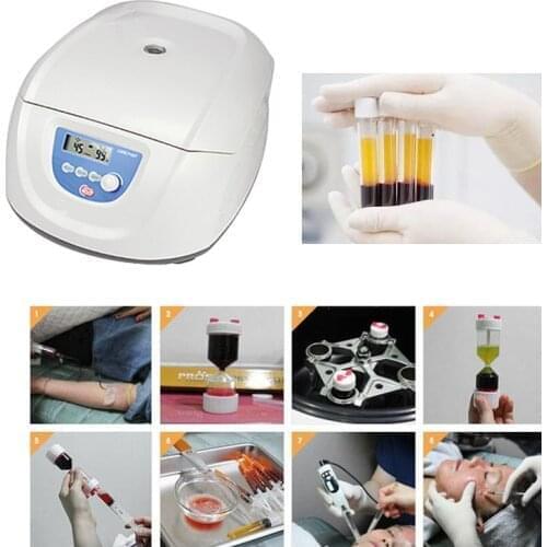 4500rpm PRF Prp Centrifuge Beauty Treatment Hair loss and Hair Transplant and Dental Laboratory centrifuge