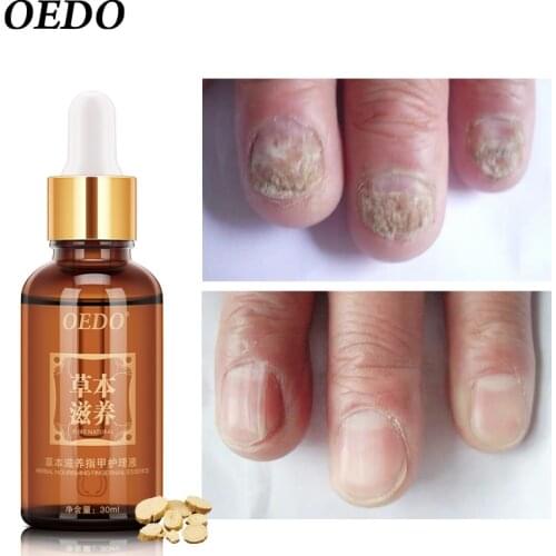 Herbal Nourishing Fingernail Essence Nail Treatment Improve Rugged Irregularity Dull Color Skin Care Repair Hands & Nails