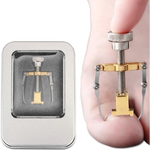 Ingrown Nail Treatment Fixer Retainer Pedicure Ingrown Toenail Foot Nail Foot Care Tools Correction Device Straightening Clip