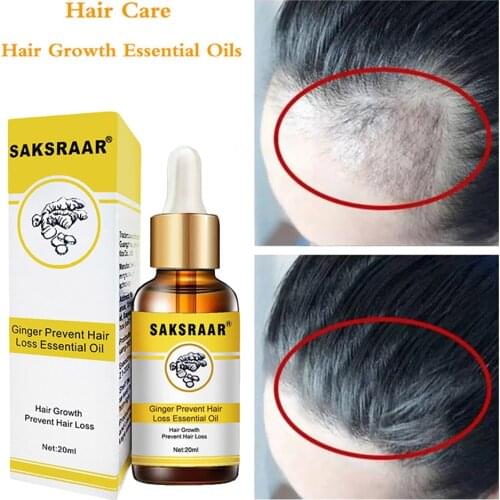 Ginger Hair Care Growth Essence Nutrient Solution To Prevent Hair Loss Plant Hair Nourishing Hair Care Essential Oil Dense Hair