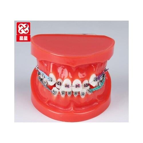 Tooth Correction Model Brackets Demo Patient communication free shipping