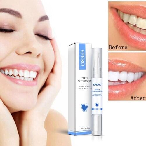 Teeth Whitening Pen Fast Cleaning Remove Plaque Stains Oral Hygiene Tool MH88