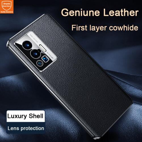 XinYaDa Vivo Phone Cases