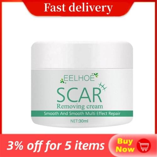 Removal Scar Cream Face Pimples Scar Stretch Marks Removal Acne Treatment Whitening Moisturizing Cream Skin Care
