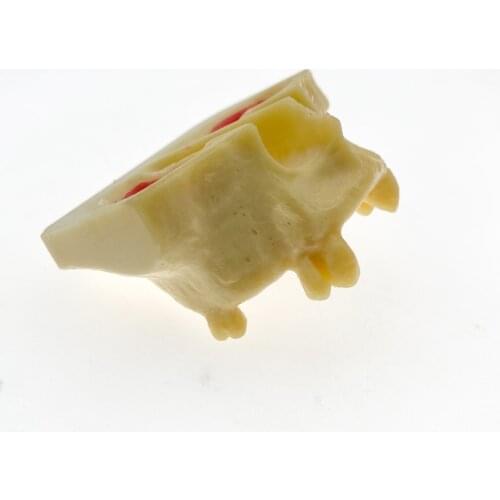 High quality Dental Sinus Lift Practice Teeth Model Typodont Study Model 2013F Model