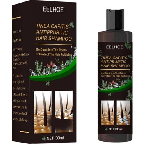 Oil Control Shampoo Moisturizing Refreshing Hair Cleansing Anti-itching Oil Control And Anti-itch Shampoo Anti-dropping Graceful