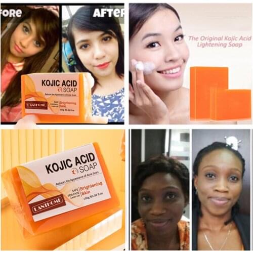 Kojic Acid Whitening Soap Dark Black Skin Lightening Soap Kojic Acid Glycerin Brighten Face Body Skin Bleaching Turmeric Soap
