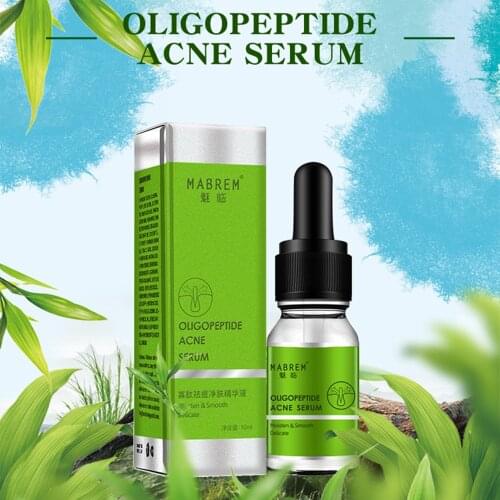 MABREM Oligopeptide Acne Cleaning Lotion Serum Face Brightening Serum Acne Scar Spots Serum Shrink Pores Eliminates Oil Control