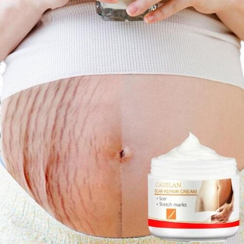 30ml peach kernel Stretch Marks Remover Cream Anti Scars Maternity Firming Eliminate Winkle Treatment Pregnancy Skin Repair T9H4