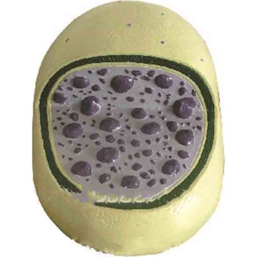 Lysosomal amplification model