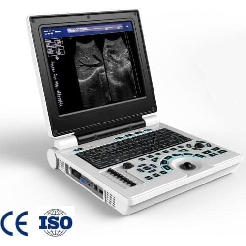 12 in High Resolution LED Screen Notebook Ultrasound USG Scanner Free Shipping
