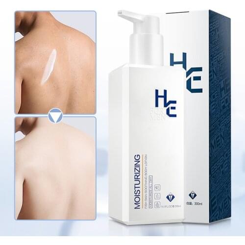Hearn skin lotion 300g mens special body moisturizing skin lotion, anti itching moisturizing emulsion