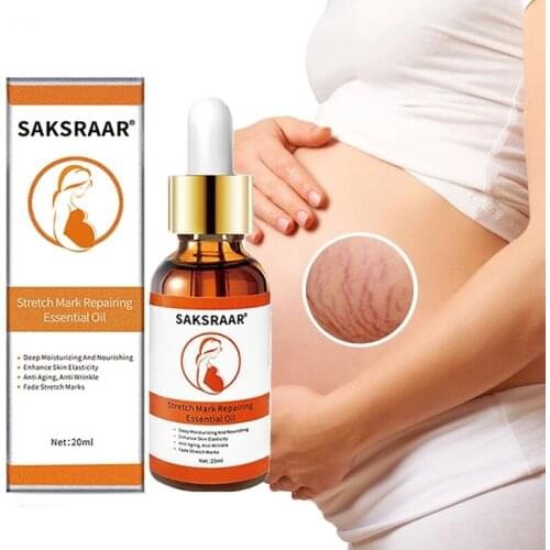 Stretch Marks Remover Essential Oil Skin Care Treatment Cream For Stretch Mark Removal Maternity Pregnant Oils