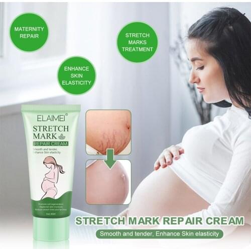 Scar Removal Cream Improve Skin Dullness Stretch And Marks Pregnant Treatment Cream Skin Ointment Waist Apply To Abdomen Thighs